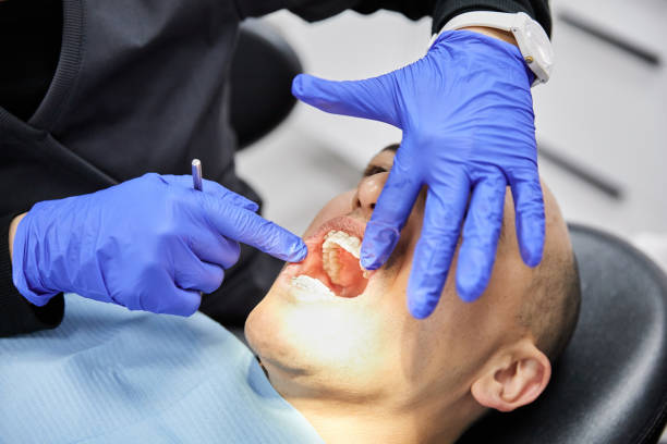 Best Tooth Infection Emergency Dentist  in Southside Place, TX