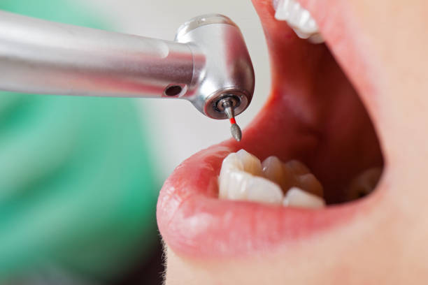 Best Broken Tooth Emergency  in Southside Place, TX
